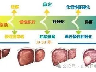 肝胆相照，肝病演变过程图