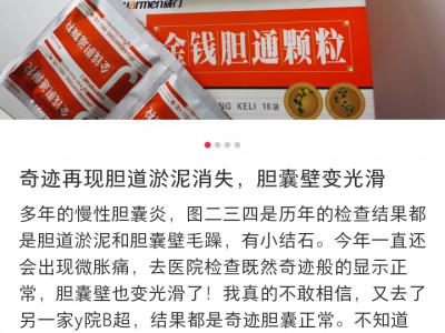 胆囊疾病中成药：金钱草颗粒