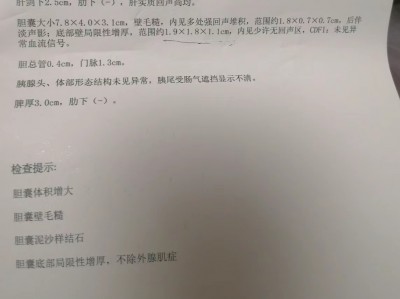 中国中医科学院西苑胆囊炎药方（本人亲测有效）