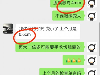 胆囊病友案例：胆囊息肉变小1N