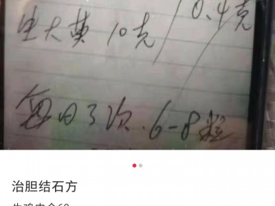 治疗胆结石的中药方31