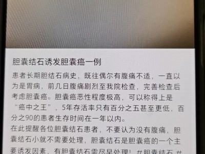 胆结石无腹痛转胆囊癌早期