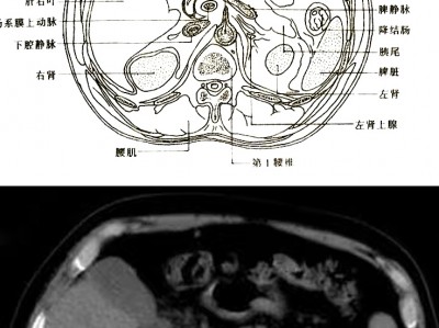 一分钟看懂腹部CT影像图