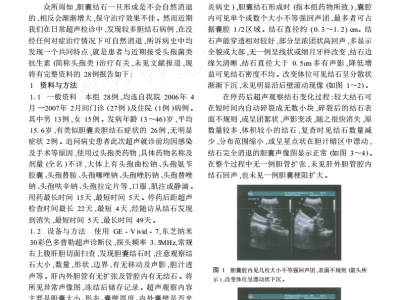 药物性头孢菌类抗生素胆囊结石的超声影像诊断