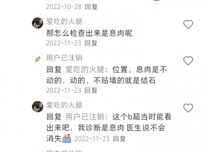 胆囊病友案例：胆结石消失-幸运者4N